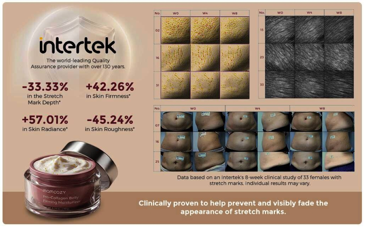 Mometry Cream Momcozy Launches Clinically Tested Skincare Solutions for Breast and ...