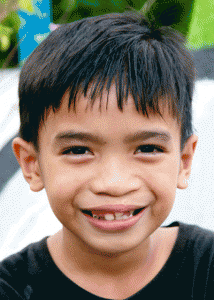 Some 750 indigent children like this boy are expected to benefit from the surgery mission