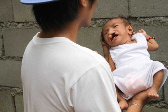 Two-month old Jan Louie Baldos has gotten the attention of the crew of the visiting US Navy Ship Millinocket because of his cleft palate. PHOTO BY LESTER A. CARDINEZ