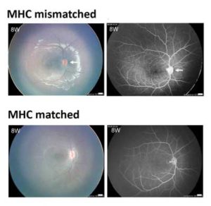 Image of monkey retinas showing the difference between geneticallymatched (lower pictures) and unmatched eye stem cells. Researchers have found that eye stem cells can be transplanted between different individuals, which could help treatment of age-related macular degeneration and other eye conditions in humans. RIKEN LAB PHOTO